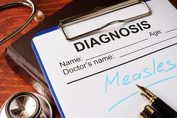 a diagnosis sheet has measles written
